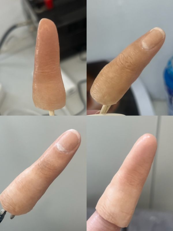 prosthetic finger-